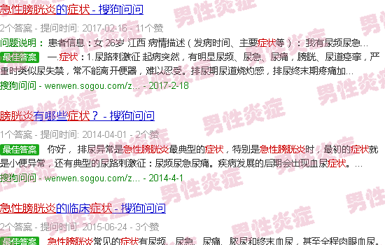 汕头急性膀胱炎症状表现