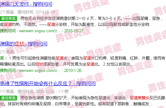 汕头尿道旁腺炎症状