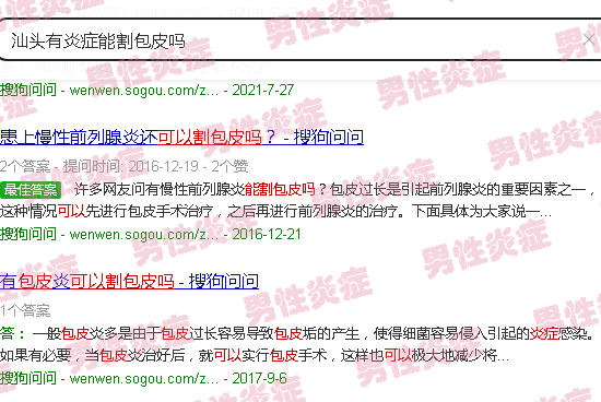 汕头有炎症能割包皮吗