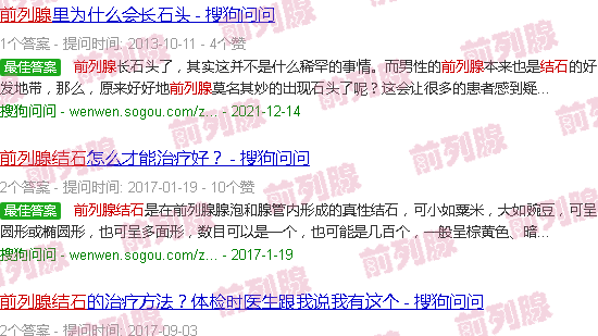 汕头前列腺结石