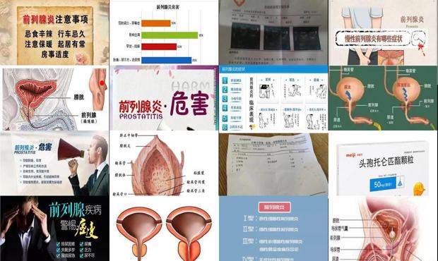 汕头急性前列腺炎