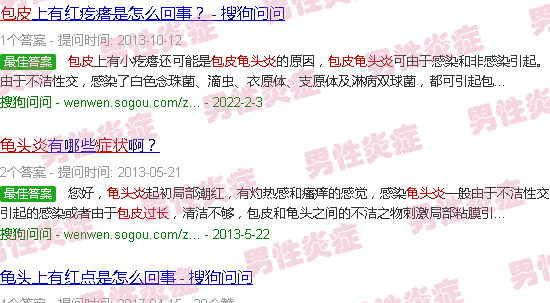 汕头包皮过长龟头炎症状