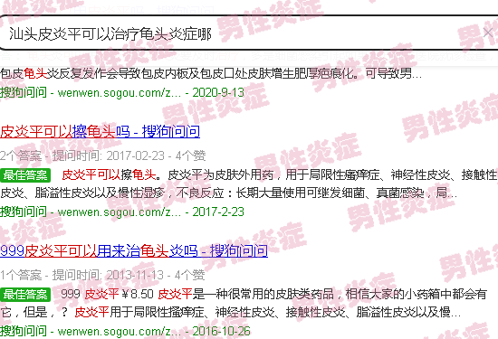 汕头皮炎平可以治疗龟头炎症哪