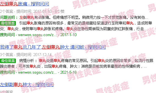 汕头左睾丸炎症会不会肿