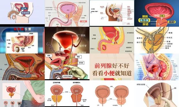 汕头前列腺在人体的位置图