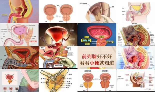 汕头人体前列腺位置图