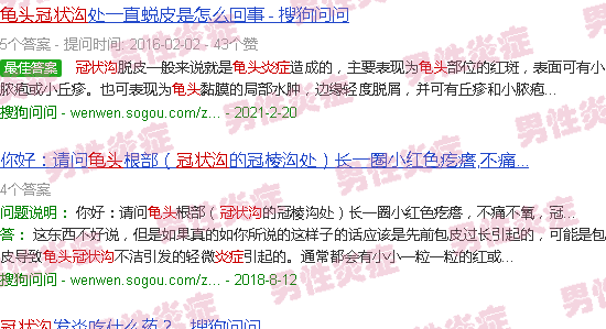 汕头龟头冠状沟炎症
