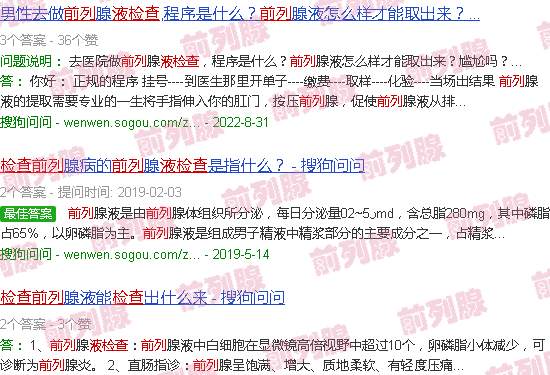 汕头前列液检查