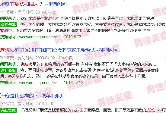 汕头皮炎症状图片