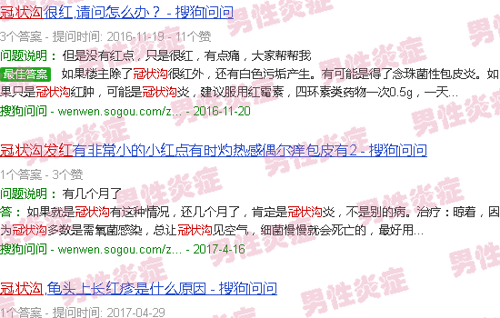 汕头冠状沟炎症图片发红