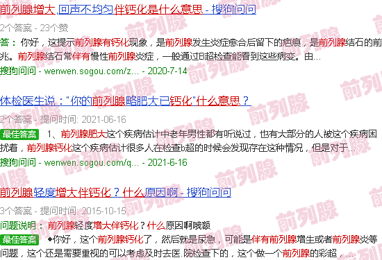汕头前列腺增大并伴有钙化是什么意思