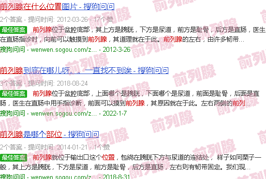 汕头前列腺在什么位置示意图