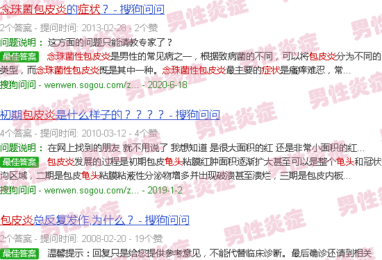 汕头念珠菌性龟头包皮炎症状