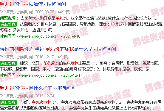 汕头前列腺睾丸炎症状