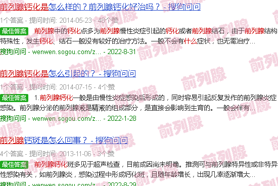 汕头前列腺钙化是什么情况