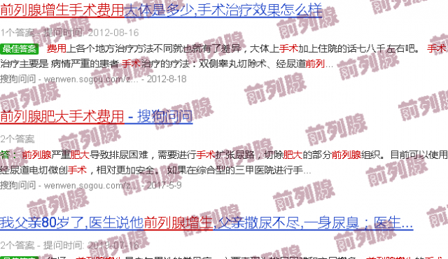 汕头前列腺肥大手术费用